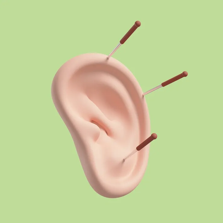 Cirurgia de correção de orelha